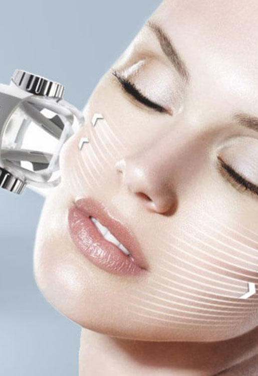Facelifting By Endermolift